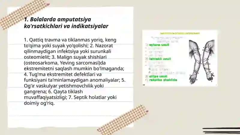 Bolalarda amputatsiya xususiyatlari 3