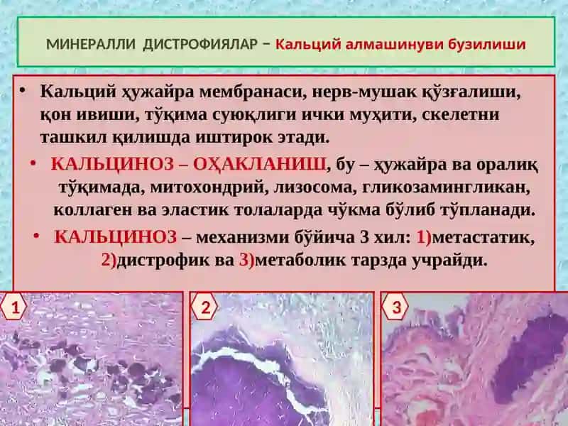 ПАТОЛОГИК АНАТОМИЯ КУРСИ 4 Маъруза 3