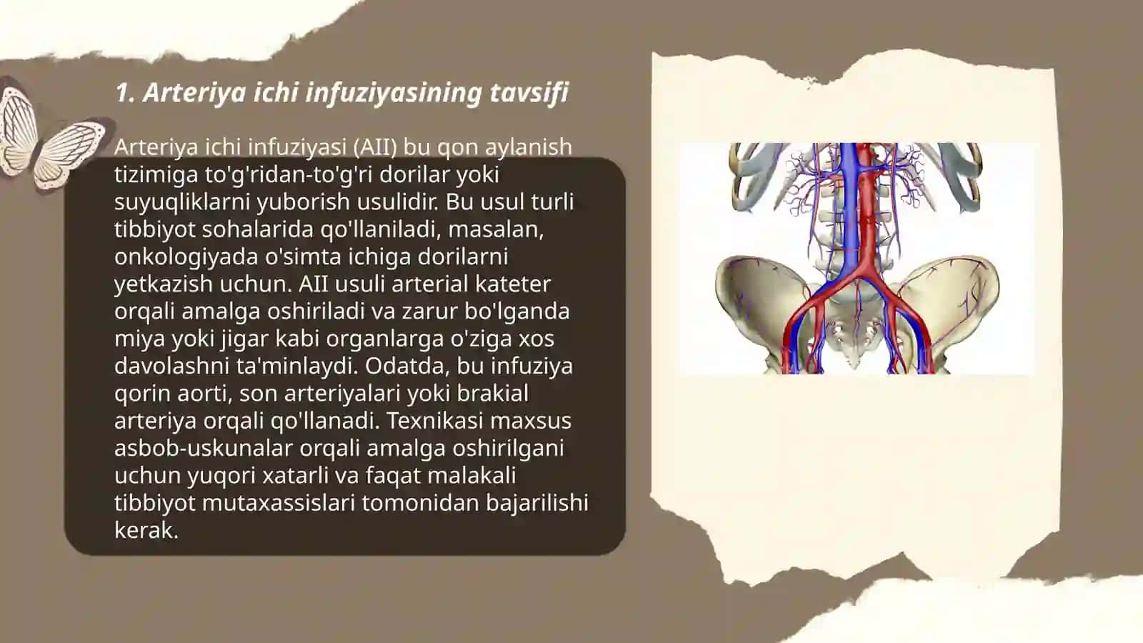 Arteriya ichi infuziyasi 3