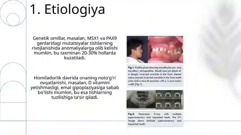 Prikusvatishlarning rivojlanishida uchraydigan anomaliyalar 3