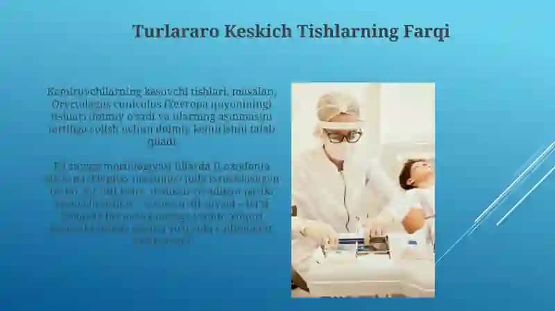 Frantal tishlar (oldingi tishlar) 3