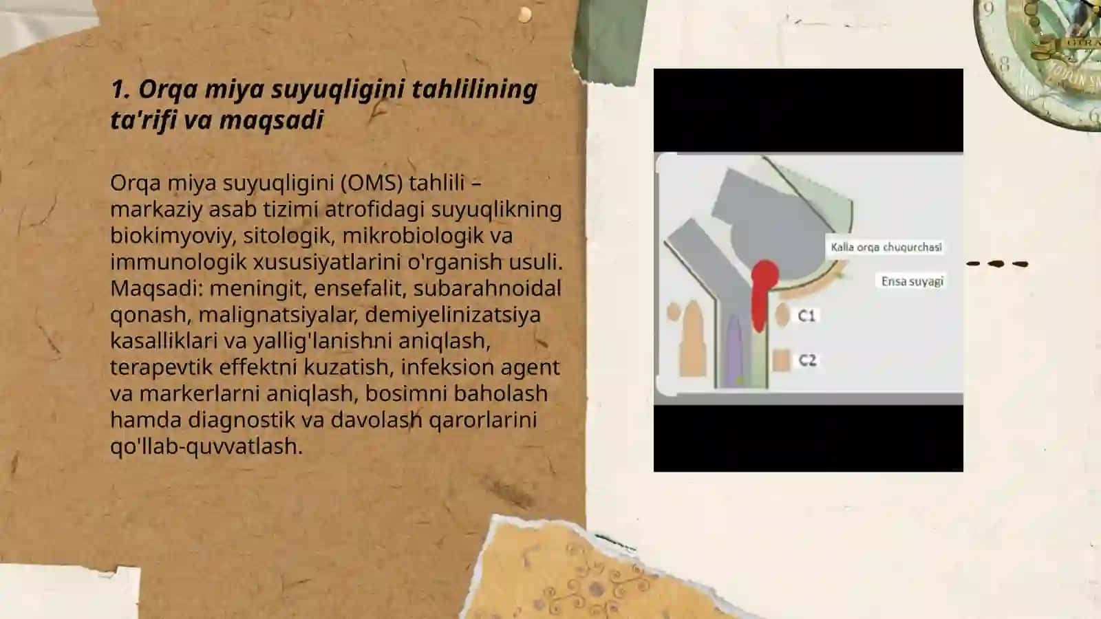 Orqa miya suyuqligi tahlili 3