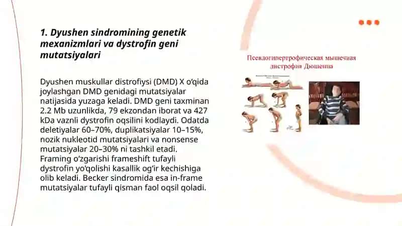 Dyushen sindromi va SMA kasalliklari 3