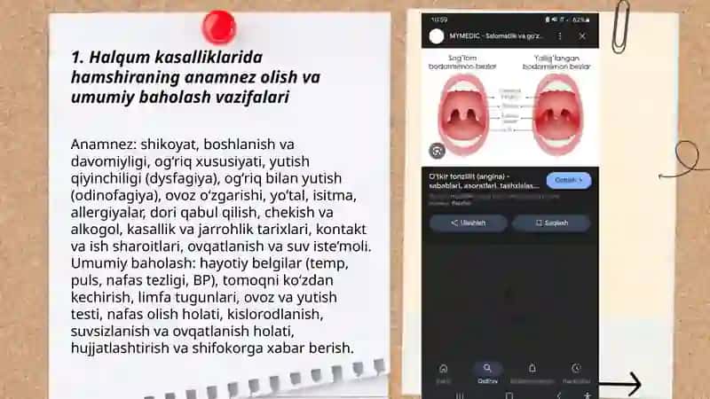 Halqum kasalliklarida hamshiraning vazifalari 3