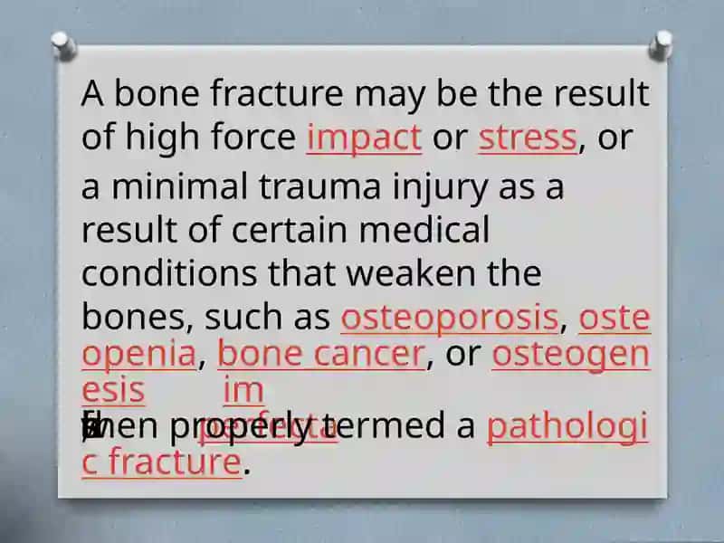 Bone fracture 3