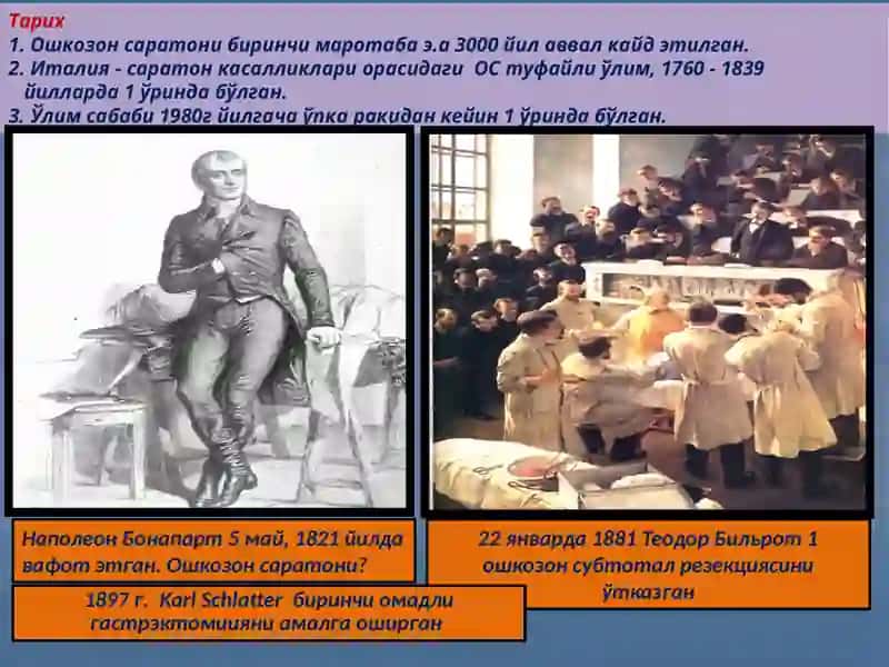 Ошқозонсаратони.Этиопатогенези,клиникаси,диагностикаси,даволашпринциплари 3
