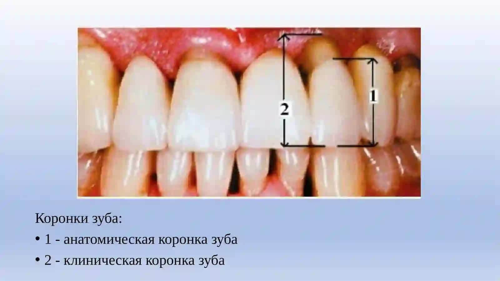 АНАТОМИЯ ЗУБОВ 3