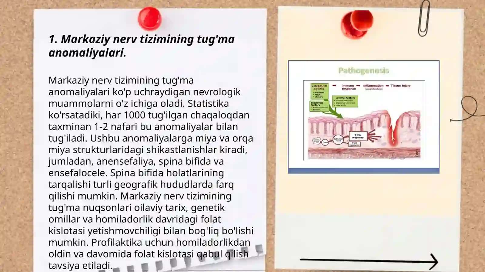Markaziy nerv sistemasi tug'ma anomaliyalari 3