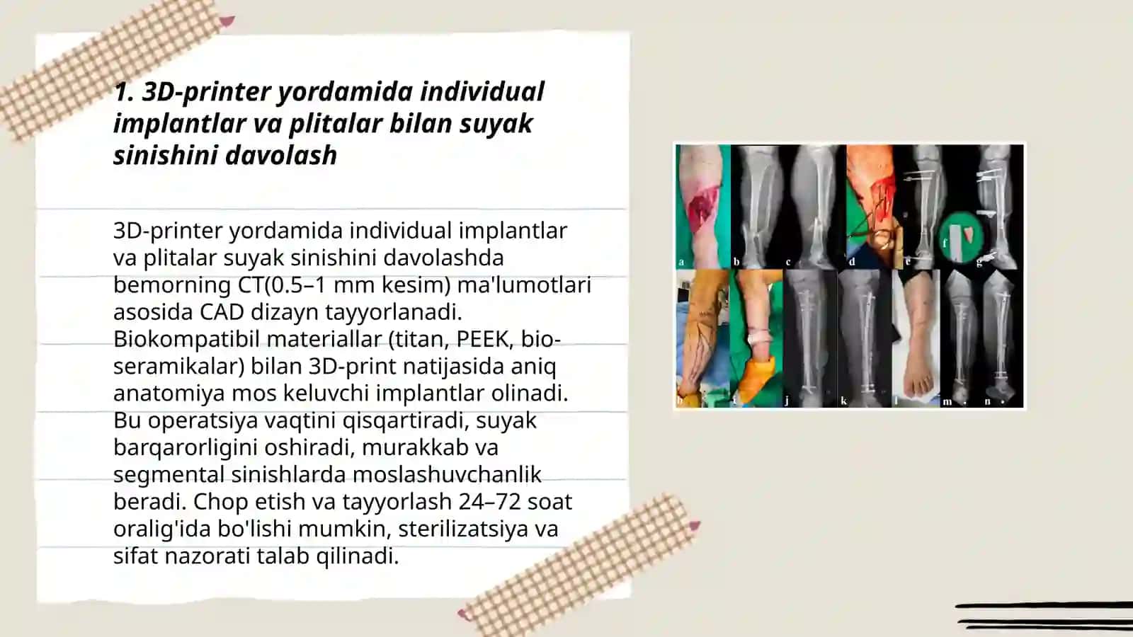 Suyaklarni sinishini davolashning yangi usullari 3
