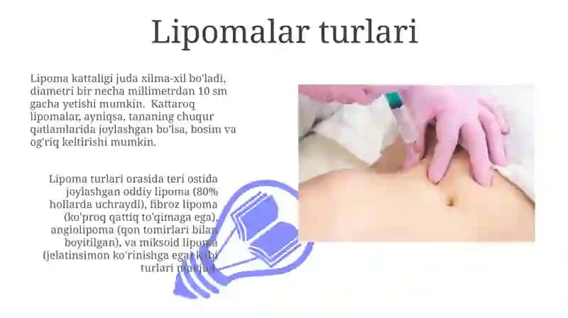 Lipomalar: Klinik ko'rinishi va diagnostikasi 3
