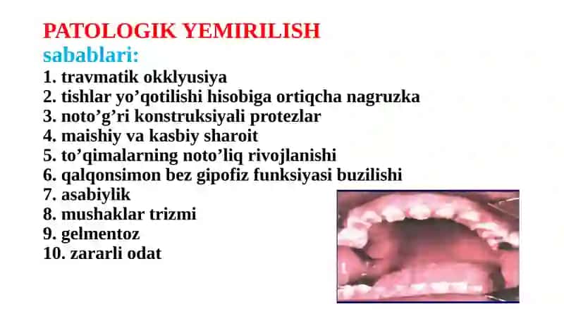 Tish chiqqandan keyingi nokariyes kasalligi 3