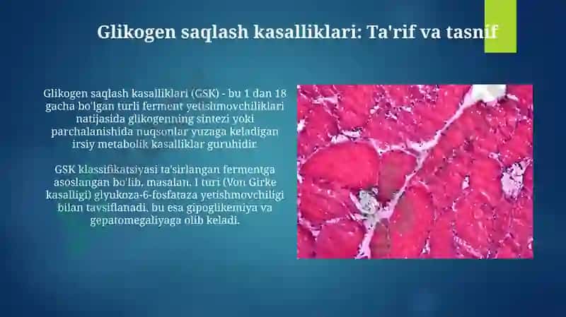 Glikogen kasalliklari 3