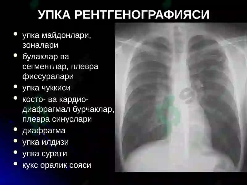УПКА КАСАЛЛИКЛАРИНИНГ НУР ТАШХИСИ 3