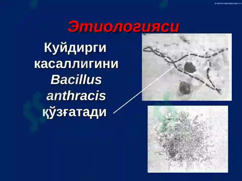 Куйдирги (Bacillus anthracis) 3