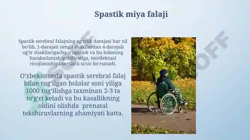 Spastik miya falaji 3