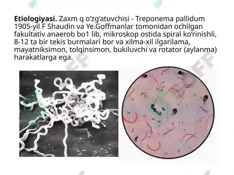 zaxm diagnostikasi - захм диагностикаси 3