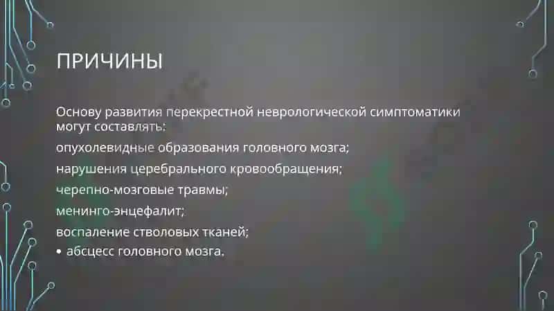 Альтернирующие синдромы 3