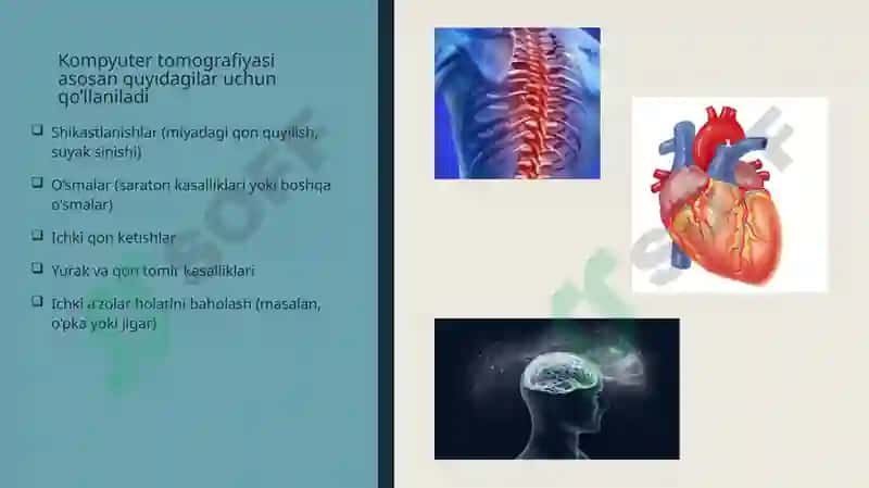 Kompyuter tomografiyasi 3