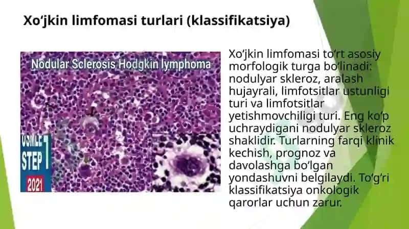 Xo’djkin limfomasi diagnostikasi va davolash usullari . Hodjkin limfomasi 3
