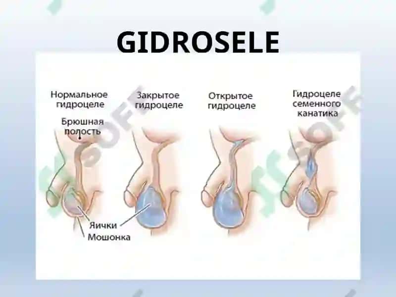 ERKAKLAR TANOSIL A`ZOLARI, AYOLLAR TANOSIL A`ZOLARI 3