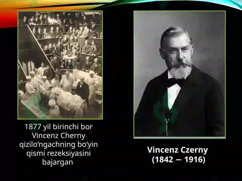 Qizilo’ngach kuyishi va yot jism 3