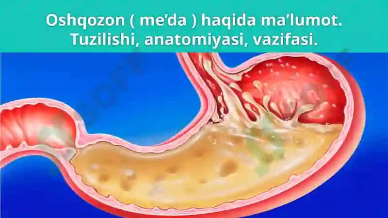Oshqozon oʻsma kasalliklari 3