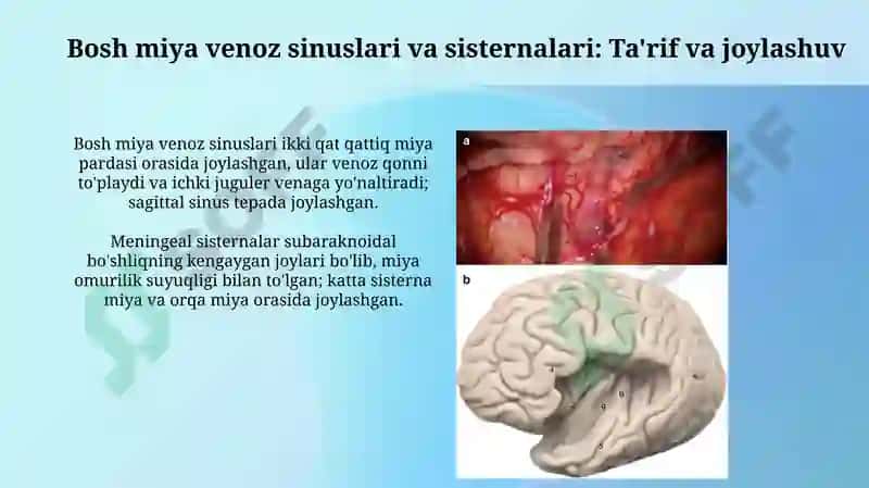 Bosh miya venoz sinuslari va sisternalari 3