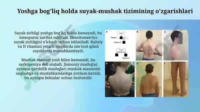 Tayanchxarakatapparatiningyoshgdbog'likxususiyatlari 3