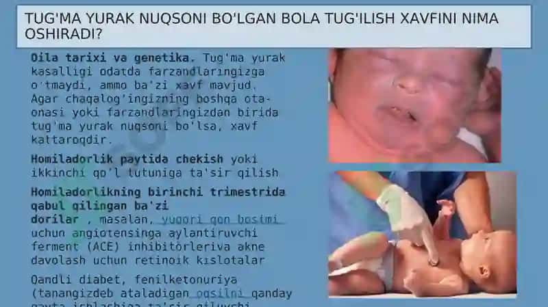 Yurakning tug'ma nuqsonlari 3