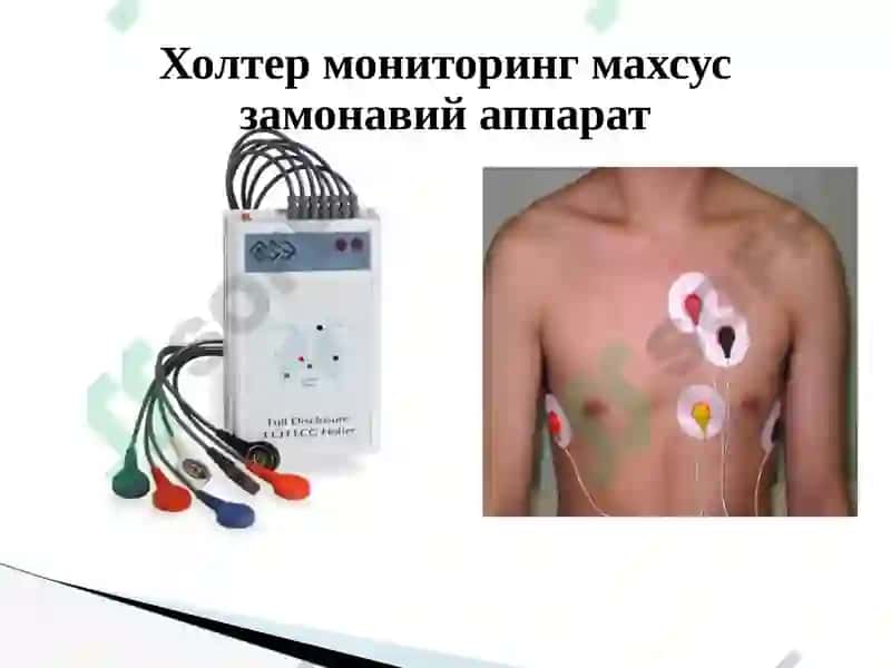 Юрак касалликларини замонавий текшириш усуллари 3