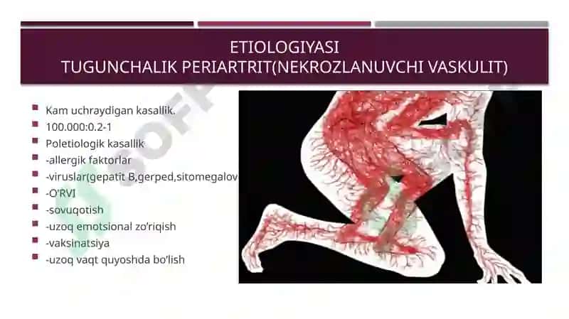 Tugunchali periartrit 3