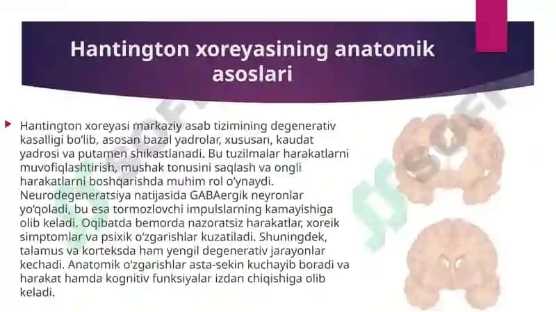 Hantington xoreyasi va meningit 3