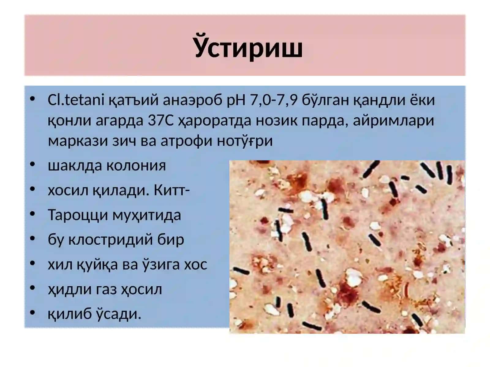 Қоқшолқўзғатувчиси 3