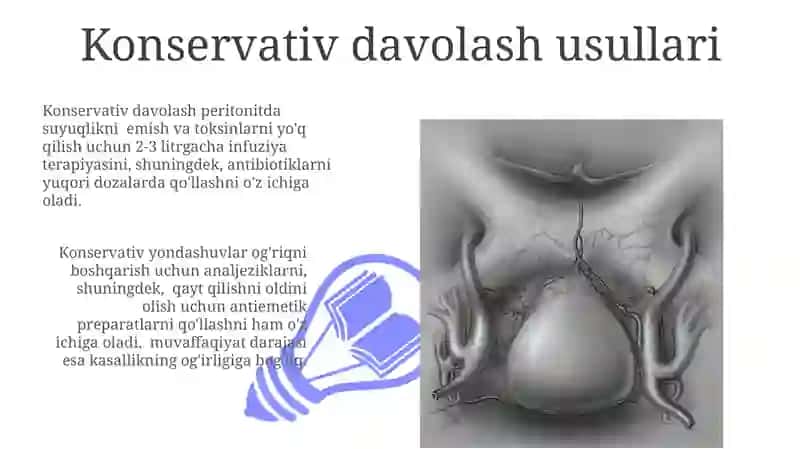 Peritonitlarda qorin bo'shlig'ini drenajlash usullari 3