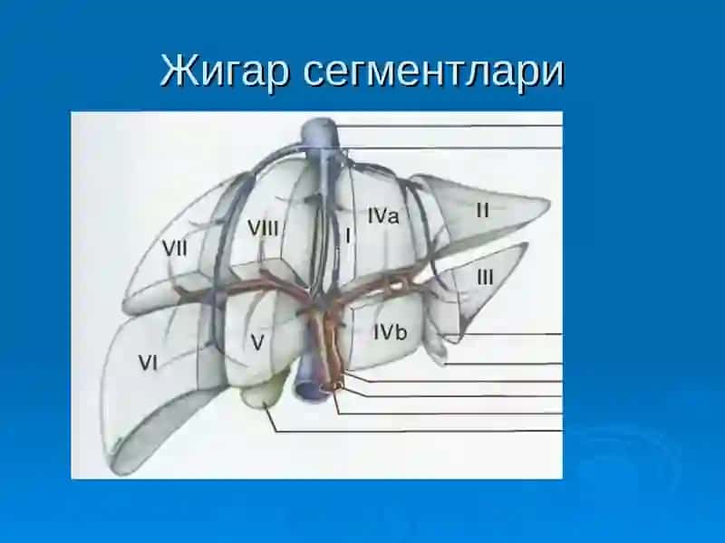 ЖИГАР РАКИ 3