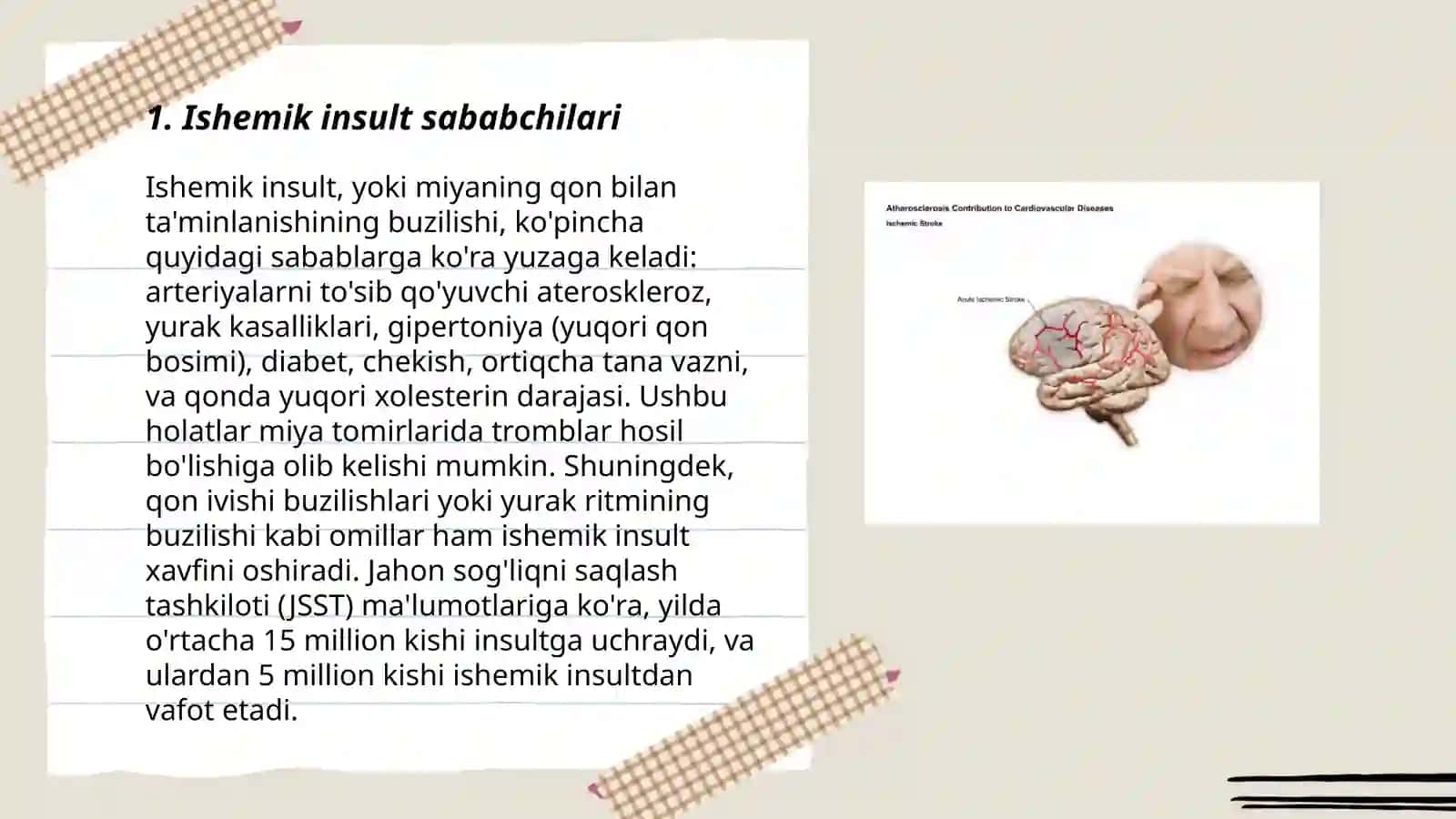 Ishemik insult sababchilari 3