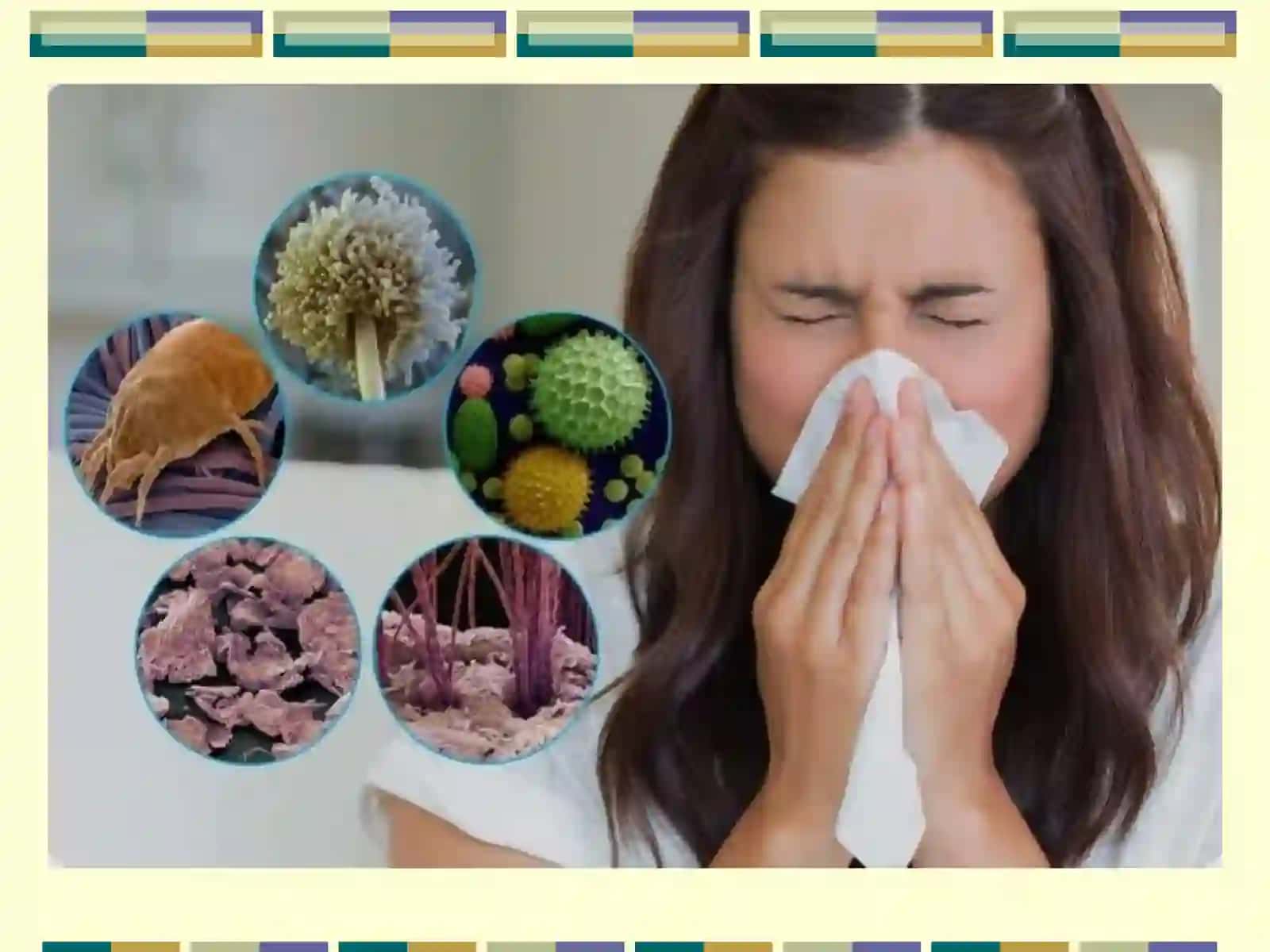 allergik kasalliklarni tashxislash usullari 3