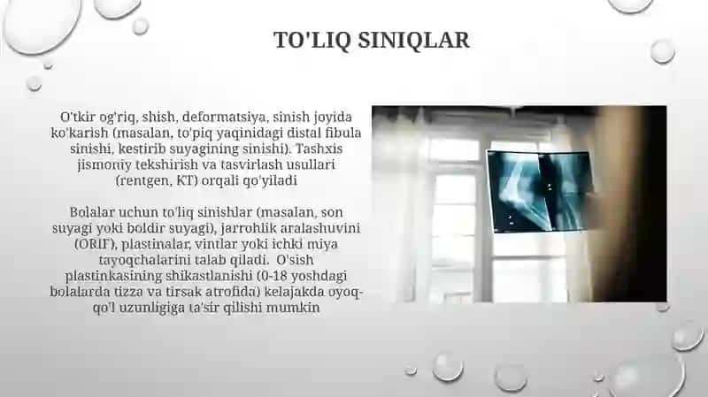 Bolalarda Suyak Shikastlarini O'ziga Xosligi 3