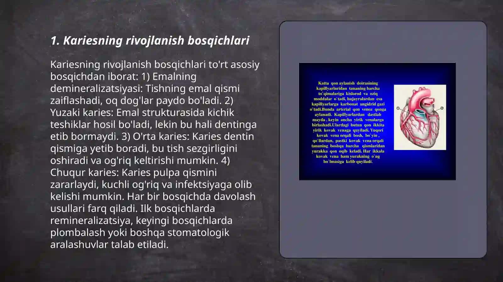 Kariesgen omillar (mahalliy umumiy) 3