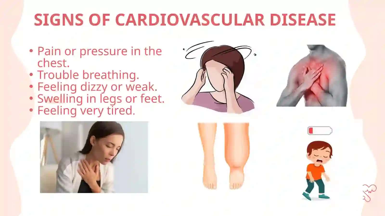 CARDIOVASCULAR DISEASE 3