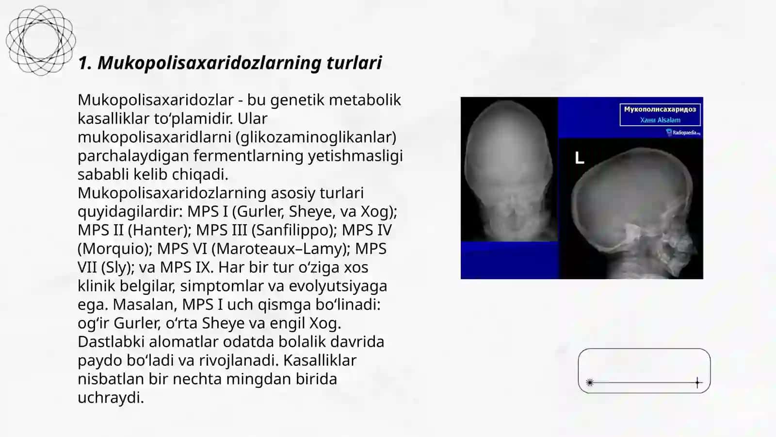 Mukopolisaxaridoz 3