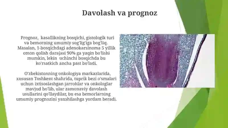 Sut bezlari Gistalogiyasi 3