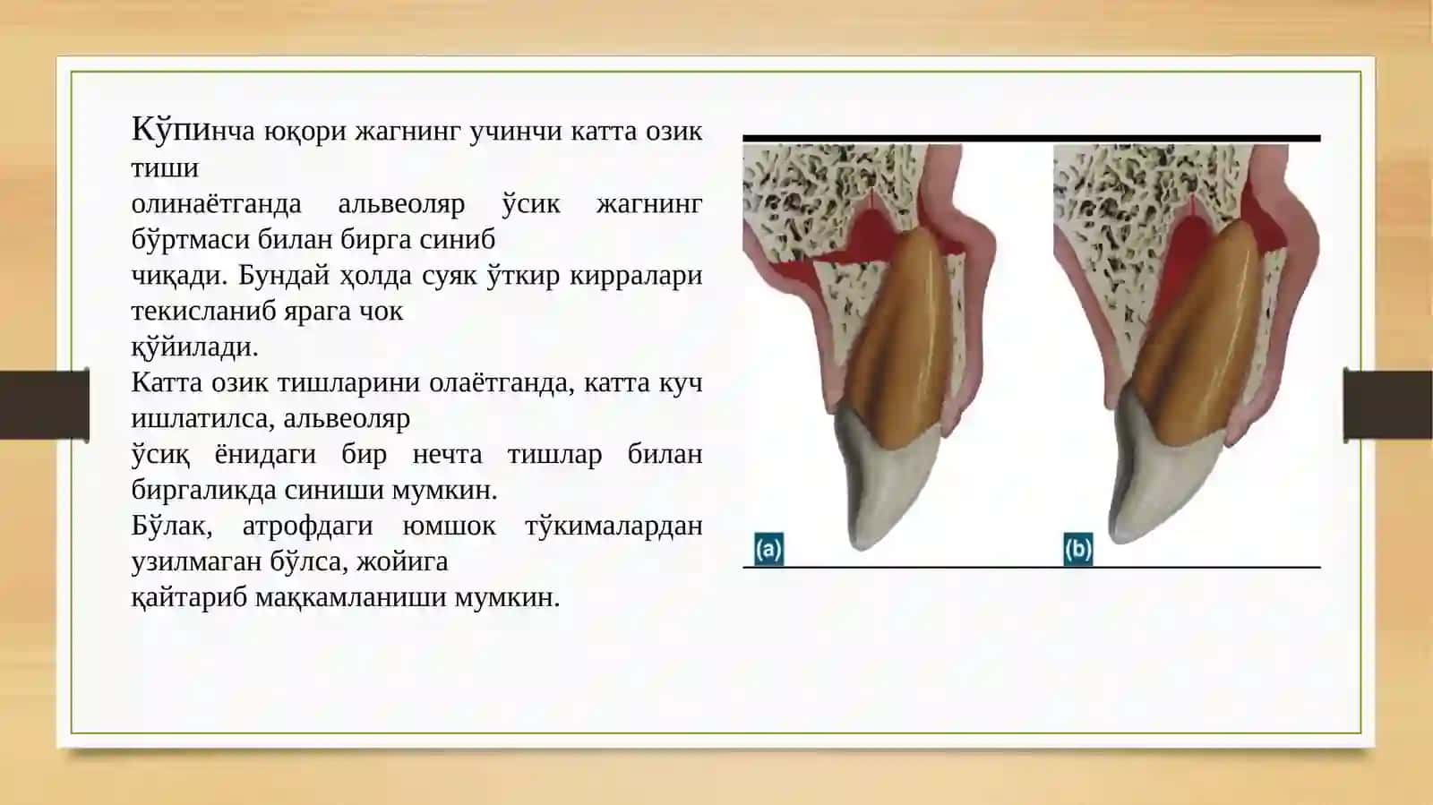 Tisholish vaqtida alveolyaro’siq vajag’si 3