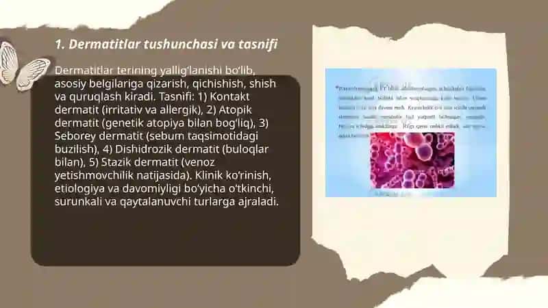 Dermatitlar. Egzima. Nevrodermit kasalliklari 3