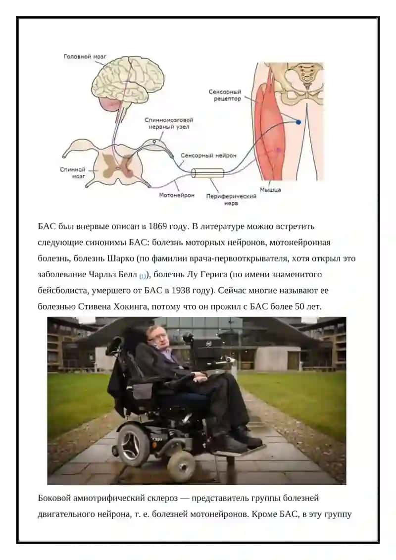 Боковой амиотрофический склероз(БАС) 3