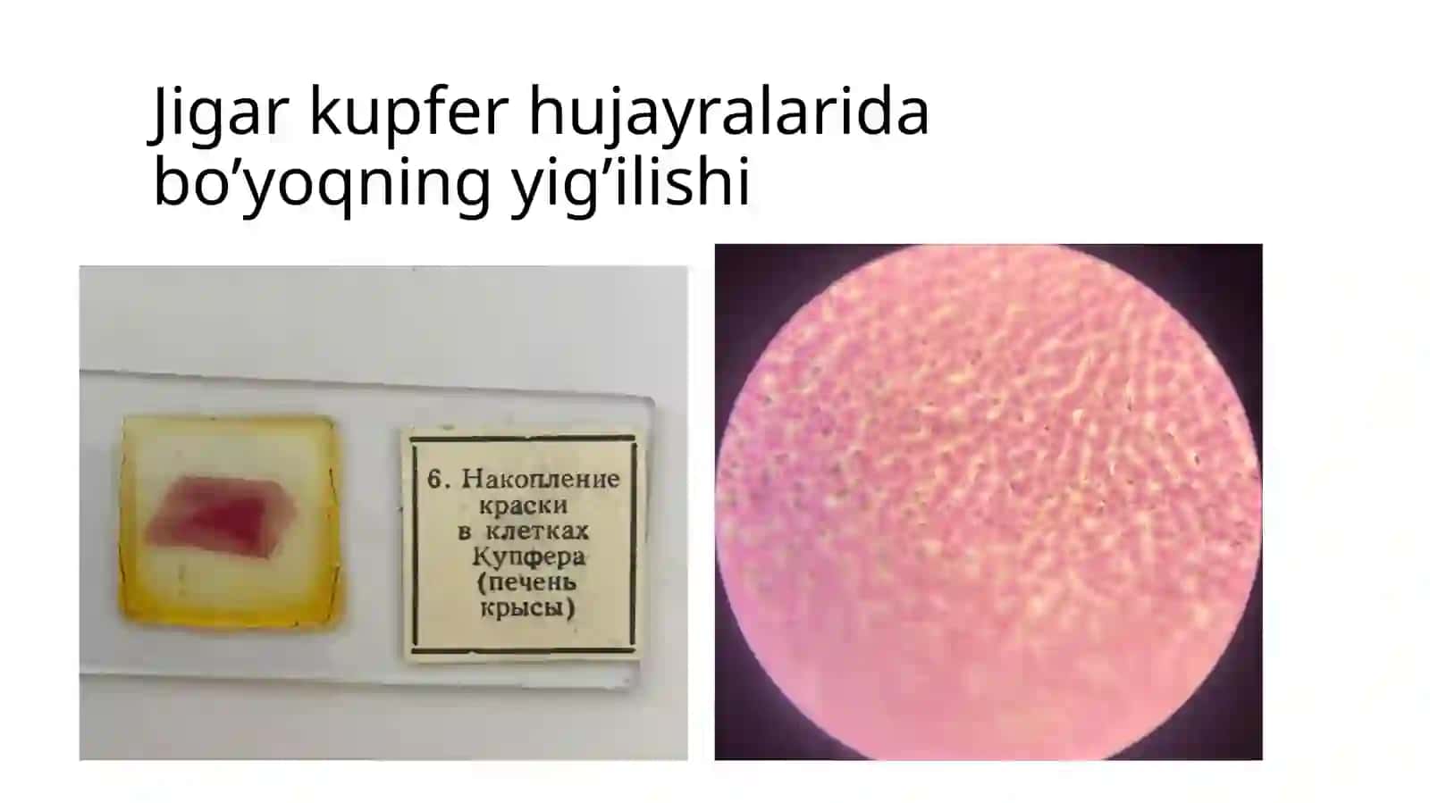 Jigarkupfer hujayralari davolash 3
