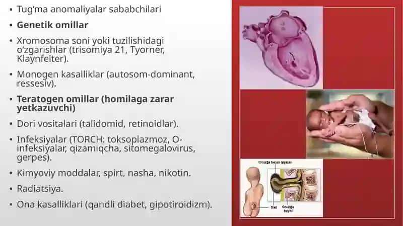 Tug’ma anomaliyalar.Chala tug’ilganlardagi buzilishlar 3
