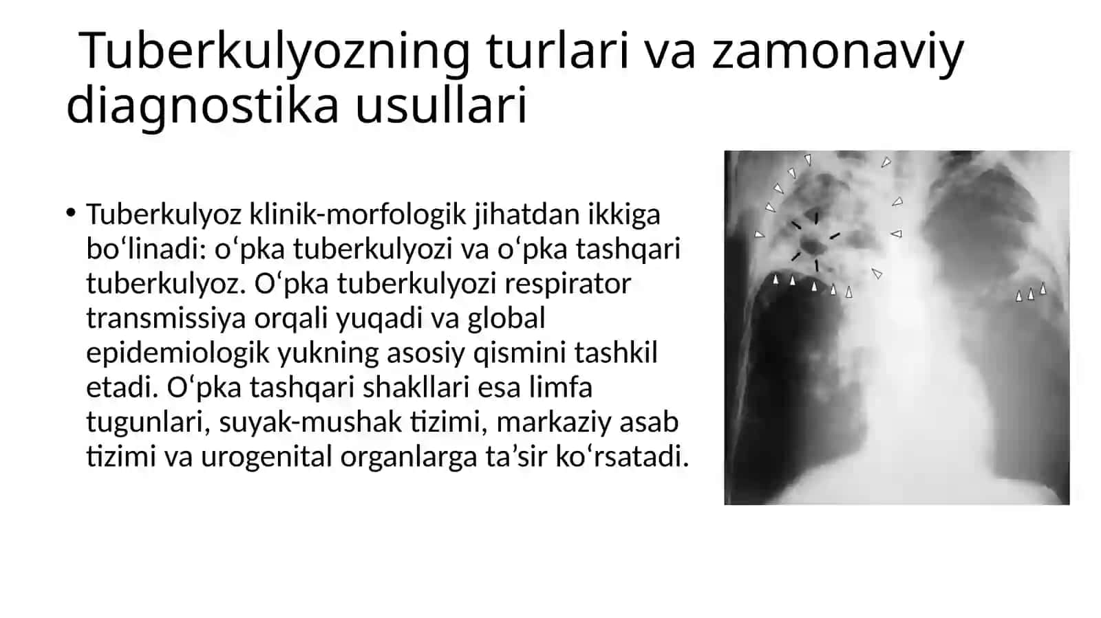 BJSST tavsiyasi 3