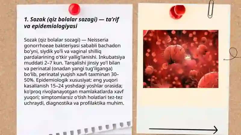 Sozak. Qiz bolalar sozagi 3