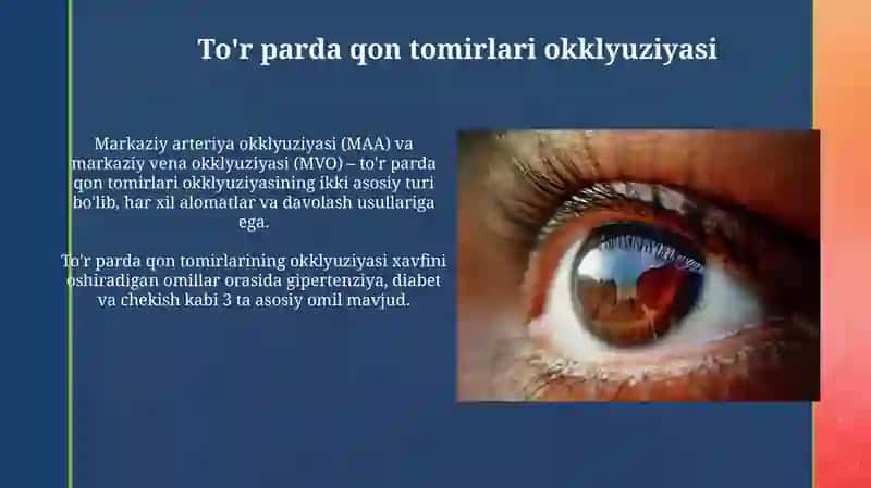Ko'z to'r pardasi degenerativ kasalliklari 3